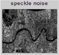 نویز خال خالی یکی از انواع نویز در پردازش تصویر
